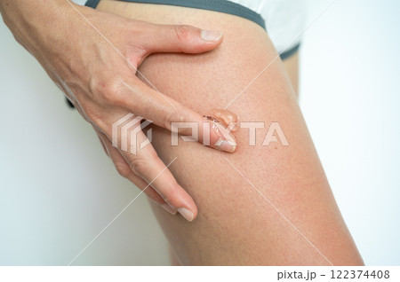 Close up of woman applying Aloe vera gel on her thigh for solving sunburn damaged. 122374408