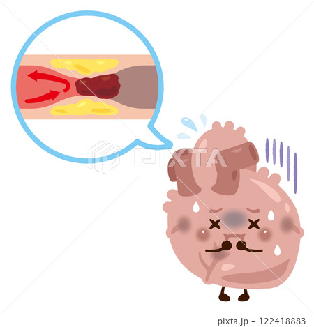 血管が詰まり心筋梗塞を起こす心臓のキャラクター 122418883