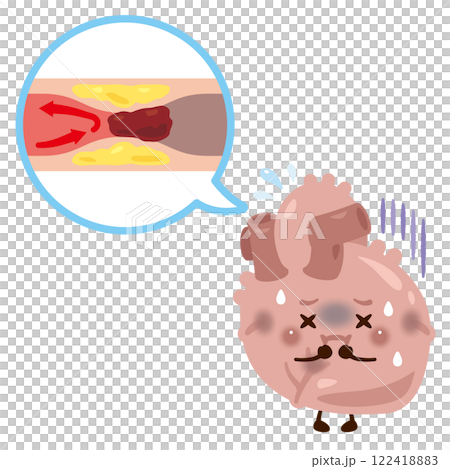 血管が詰まり心筋梗塞を起こす心臓のキャラクター 122418883