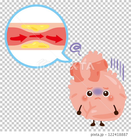 心絞痛心臟性格 122418887