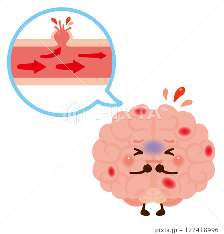 血管が破れて脳出血を起こす脳のキャラクター 血管が破れて脳出血を起こす脳のキャラクター 122418996