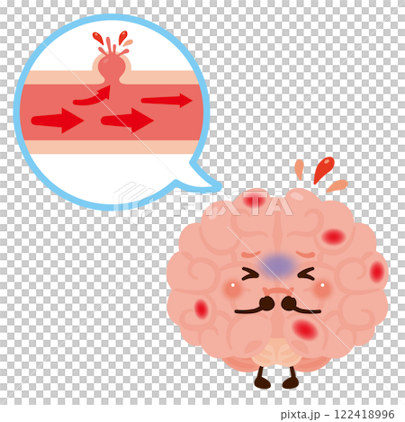 血管が破れて脳出血を起こす脳のキャラクター 血管が破れて脳出血を起こす脳のキャラクター 122418996