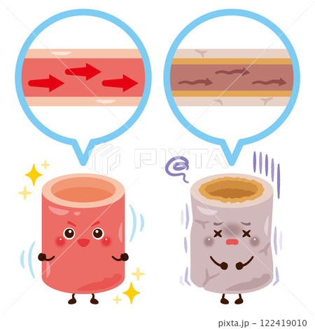 柔らかくて健康な血管と硬くて不健康な血管のキャラクターイラスト 柔らかくて健康な血管と硬くて不健康な血管のキャラクターイラスト 122419010