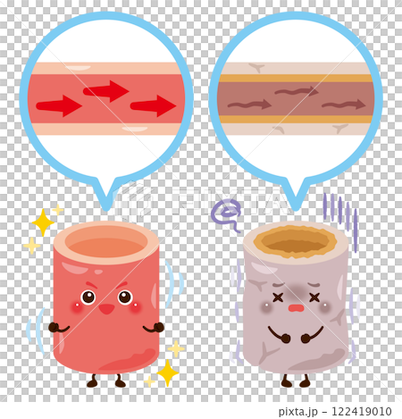 柔らかくて健康な血管と硬くて不健康な血管のキャラクターイラスト 柔らかくて健康な血管と硬くて不健康な血管のキャラクターイラスト 122419010