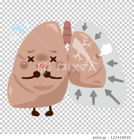 Collapsed lung character with pneumothorax Collapsed lung character with pneumothorax 122419030