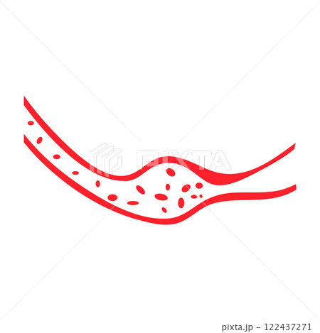 vector of cholesterol plaque 122437271