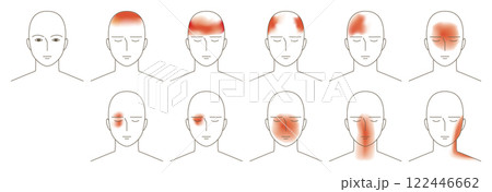 頭痛のする場所の頭部。前面から見たイメージイラスト。 122446662