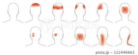 頭痛のする場所。後頭部のイメージイラスト。 122446663