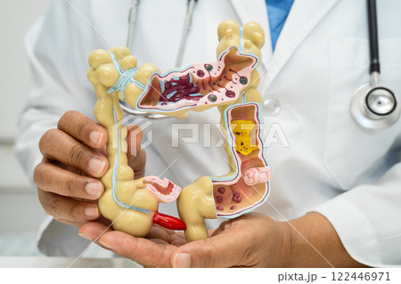 Intestine, appendix and digestive system, doctor holding anatomy model for study diagnosis and treatment in hospital. Intestine, appendix and digestive system, doctor holding anatomy model for study diagnosis and treatment in hospital. 122446971