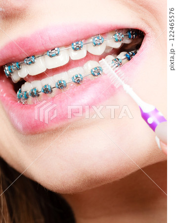 Woman brushing teeth with braces using brush Woman brushing teeth with braces using brush 122465576