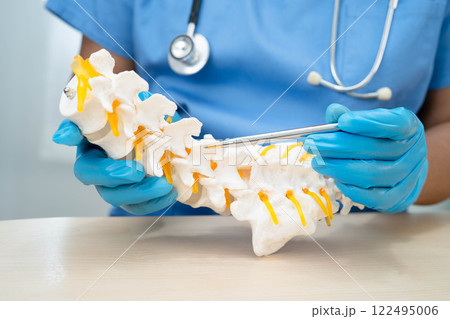 Asian doctor holding spinal nerve and bone model, Lumbar spine displaced herniated disc fragment for treatment medical in the orthopedic department. 122495006