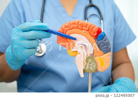 Alzheimer disease, Asian doctor holding brain anatomy model for study diagnosis and treatment in hospital. 122495007