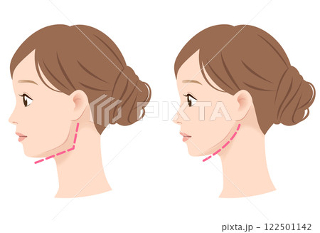 エラの張った女性の横顔 ビフォーアフター エラの張った女性の横顔 ビフォーアフター 122501142