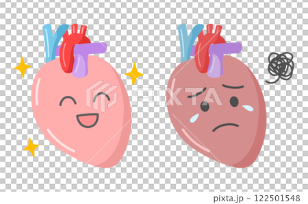Cute illustration of a healthy heart compared to a diseased heart 122501548