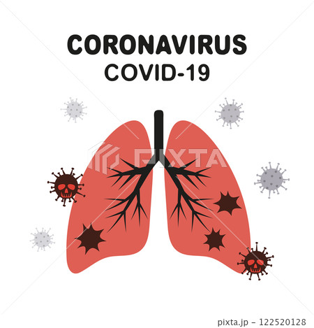 2019-nCoV virus vector illustration. Coronavirus infected human lungs 122520128
