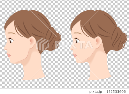 Profile of a woman with a prominent jawline: before and after 122533606