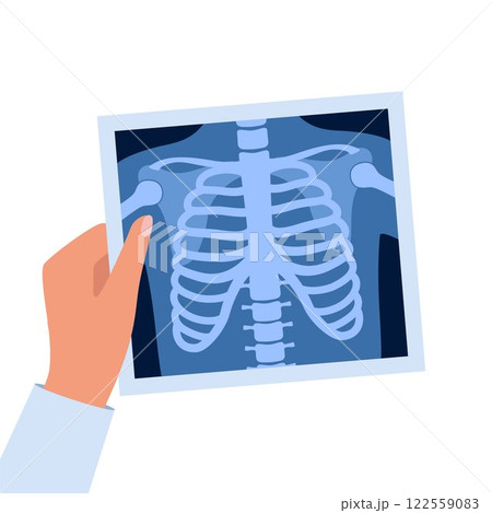 X ray of human skeleton chest and pelvis human bones. Roentgen shot in doctors hand. Medical analyzing. Anatomical bone medicine laboratory radial scan. Vector. 122559083