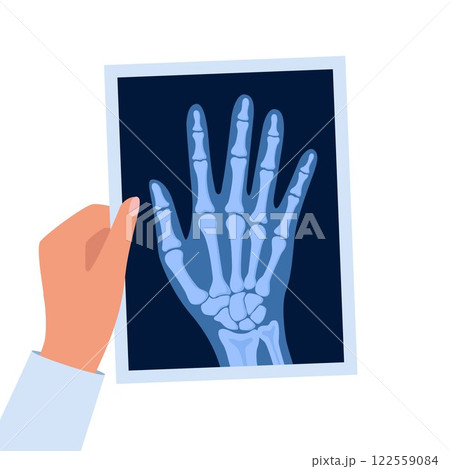 X ray human hand. Body bone roentgen front view. Medical anatomy. Arm checking healthcare joint palm finger exam. Roentgen shot in doctors hand. Vector illustration. 122559084