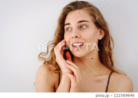Close-up of a cute woman with problem skin looking in the mirror. Dermatology concept, allergy. Close-up of a cute woman with problem skin looking in the mirror. Dermatology concept, allergy. 122569646