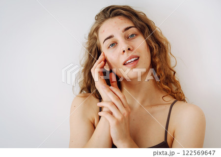 Close-up of a cute woman with problem skin looking in the mirror. Dermatology concept, allergy. 122569647