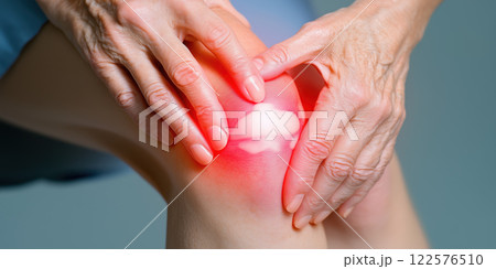 Knee pain and inflammation caused by arthritis or gout in elderly person Knee pain and inflammation caused by arthritis or gout in elderly person 122576510