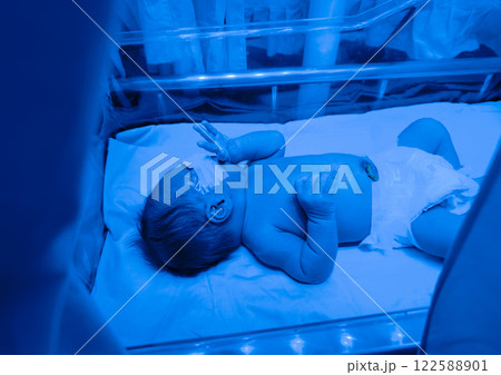 Newborn baby boy under phototherapy lamp. Newborn baby boy under phototherapy lamp. 122588901