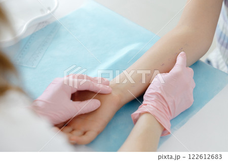 Doctor doing skin allergy test at white table in office. Allergy test - skin prick allergy testing for possible allergens Doctor doing skin allergy test at white table in office. Allergy test - skin prick allergy testing for possible allergens 122612683