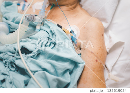 Patient do tracheostomy and ventilator in hospital Patient do tracheostomy and ventilator in hospital 122619024