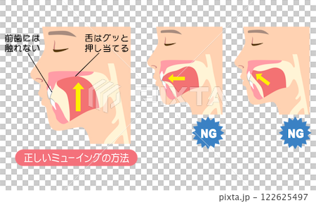 正しいミューイングの方法　適正な舌の位置と誤った舌の位置 122625497