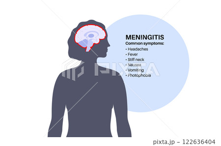 Meningitis medical poster 122636404