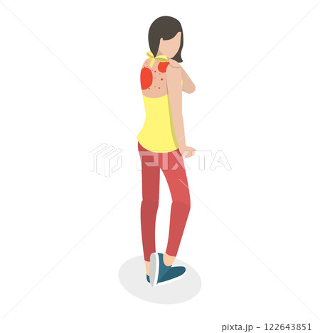 3D Isometric Flat  Illustration of Skin Acne And Allergy. Item 1 122643851