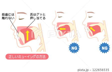 正しいミューイングの方法　適正な舌の位置と誤った舌の位置 122656535