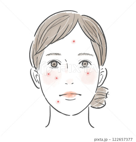 顔にニキビのあるまとめ髪の女性 122657377