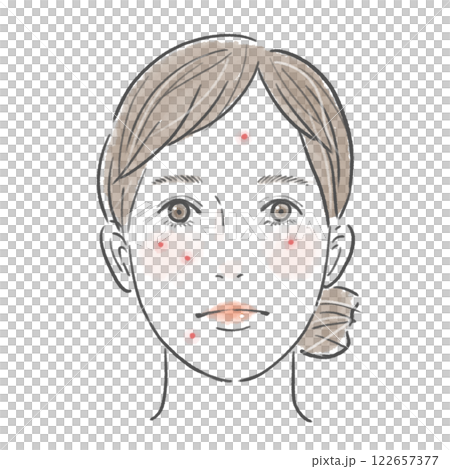 顔にニキビのあるまとめ髪の女性 122657377