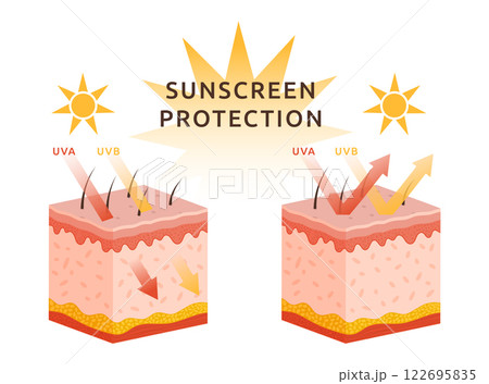 Protect skin from UV sun. Rays arrow damage. UVA and UVB reflecting heat. Structure of layer epidermis. Human body. Dermis section chart. Sunscreen protection infographic. Vector garish illustration Protect skin from UV sun. Rays arrow damage. UVA and UVB reflecting heat. Structure of layer epidermis. Human body. Dermis section chart. Sunscreen protection infographic. Vector garish illustration 122695835