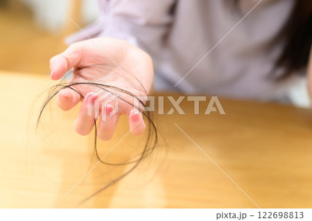 女性 抜け毛 脱毛症 FAGA 女性 抜け毛 脱毛症 FAGA 122698813