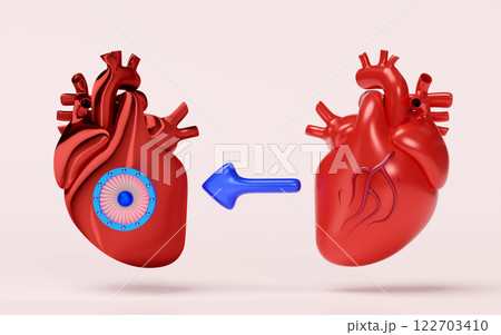 3d artificial heart with realistic human heart isolated on pink background. Future innovation, heart transplantation concept, 3d illustration render 122703410