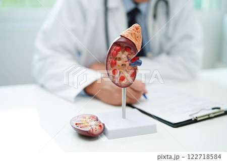 Chronic kidney disease, doctor with model for treatment urinary system, urology, Estimated glomerular filtration rate eGFR. Chronic kidney disease, doctor with model for treatment urinary system, urology, Estimated glomerular filtration rate eGFR. 122718584