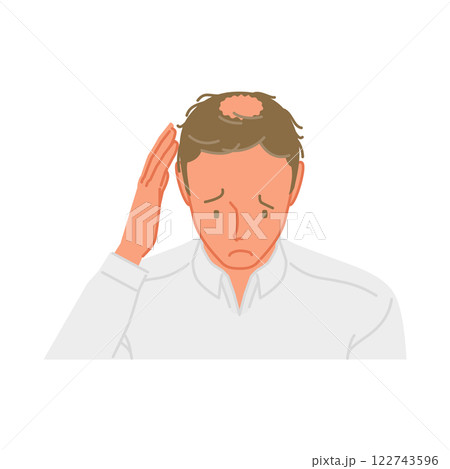 AGA:薄毛を気にして頭に手を当てる若い男性 AGA:薄毛を気にして頭に手を当てる若い男性 122743596
