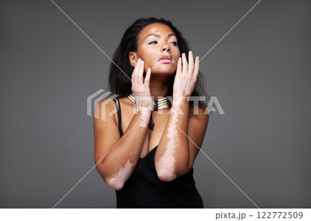 Sensuous fashion model with vitiligo posing over 122772509