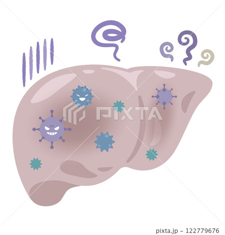 ウイルス性肝炎になった肝臓のイラスト 122779676