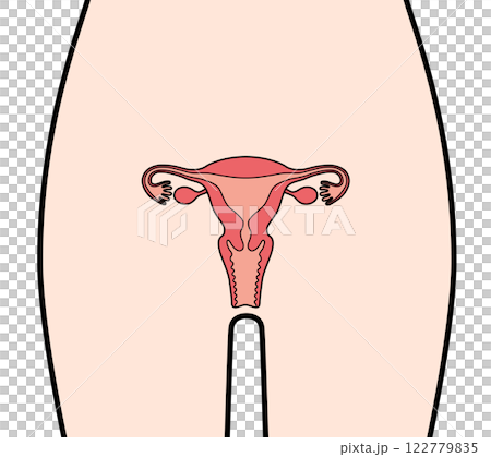 人類子宮 122779835