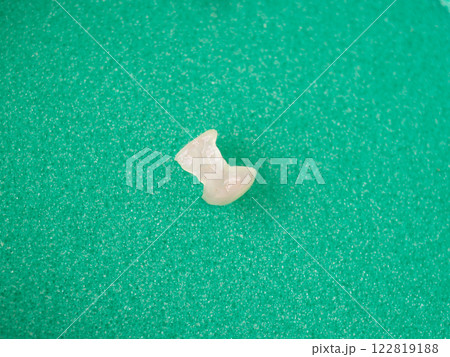 セラミックインレー 歯科 自費治療 詰め物 122819188