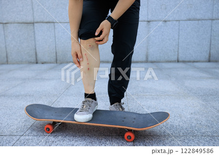 Sports injury, skateboarder with injured knees 122849586