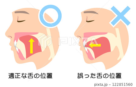 正しいミューイングの方法 適正な舌の位置と誤った舌の位置 正しいミューイングの方法 適正な舌の位置と誤った舌の位置 122851560