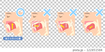 How to mew properly: correct and incorrect tongue position 122851584