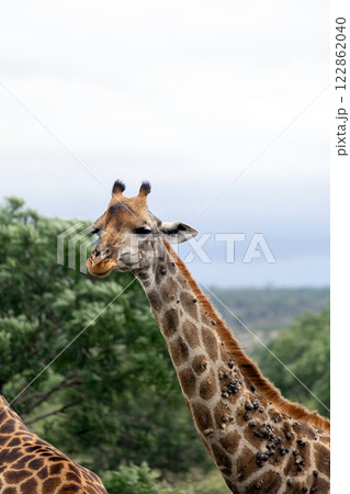 Sick giraffe with growths on neck 122862040