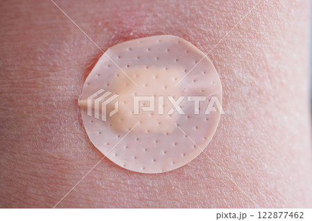 Round adhesive plaster on man arm close up 122877462