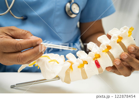 Asian doctor holding spinal nerve and bone model, Lumbar spine displaced herniated disc fragment for treatment medical in the orthopedic department. Asian doctor holding spinal nerve and bone model, Lumbar spine displaced herniated disc fragment for treatment medical in the orthopedic department. 122878454
