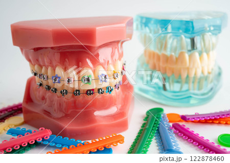 Orthodontic ligatures rings and ties, elastic rubber bands on orthodontic braces, model for dentist studying about dentistry. 122878460